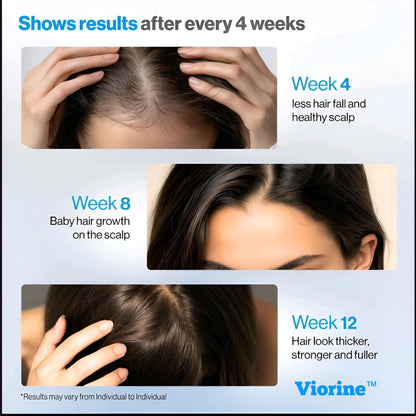 Viorine™ Hair Regrowth Roll-On Serum