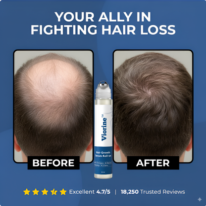 Viorine™ Hair Regrowth Roll-On Serum