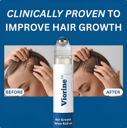 Viorine™ Hair Regrowth Roll-On Serum