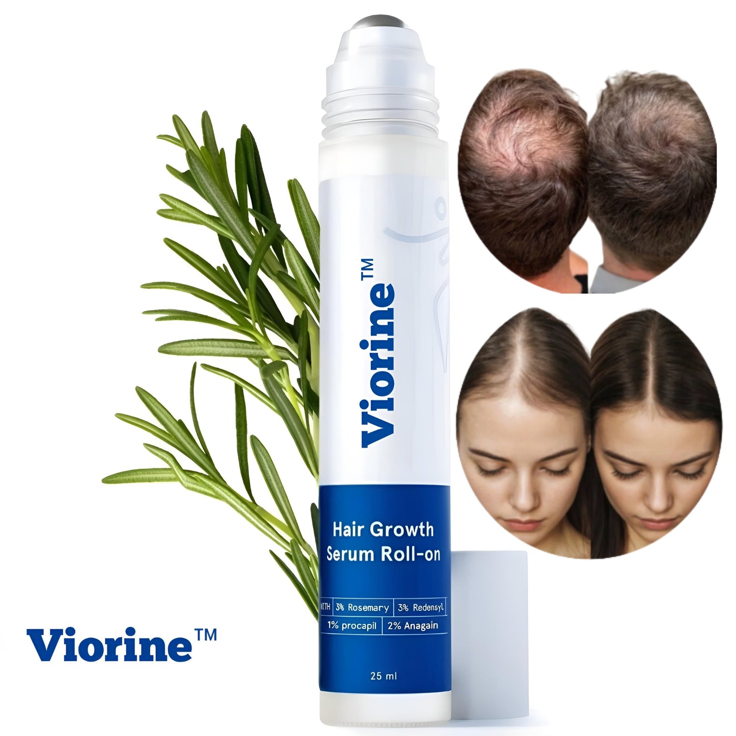 Viorine™ Hair Regrowth Roll-On Serum