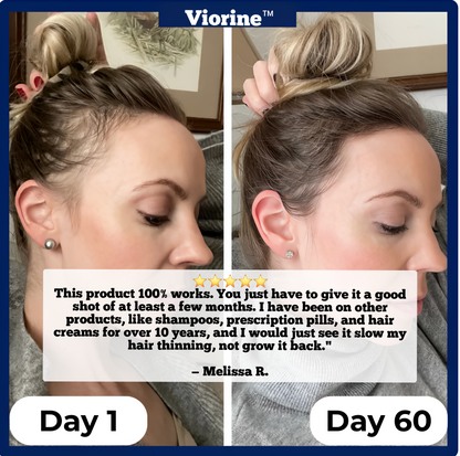 Viorine™ Hair Regrowth Roll-On Serum